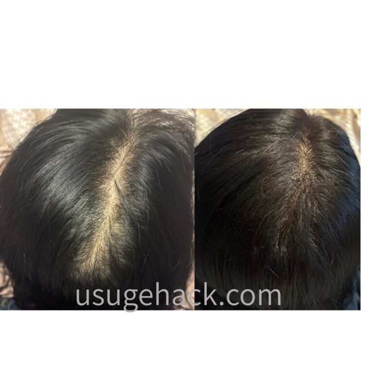 レディーストップシェード パウダーヘア（柳屋本店）の使用前（左）と使用後（右）の分け目の比較。薄毛・地肌のカバー効果。