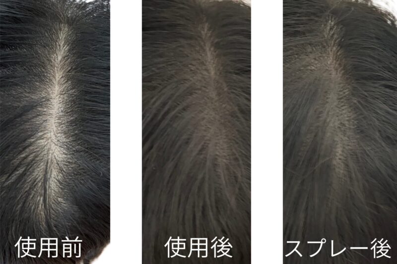 アートミクロンプラビの使用前（地肌が目立つ状態）、パウダー使用後、専用スプレーで仕上げた後の3段階比較写真。