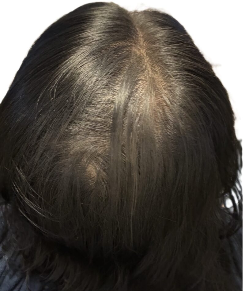 サロンドプロ カラーオンスプレー（ダークブラウン系）の使用後。白髪や地肌がカバーされた分け目と後頭部の写真。