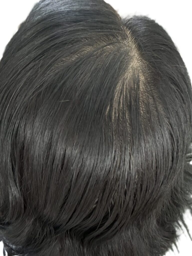 増毛スプレー使用前、寝起きの髪をヘアブラシで丁寧に整えた後頭部の写真。地肌の透け具合を確認。