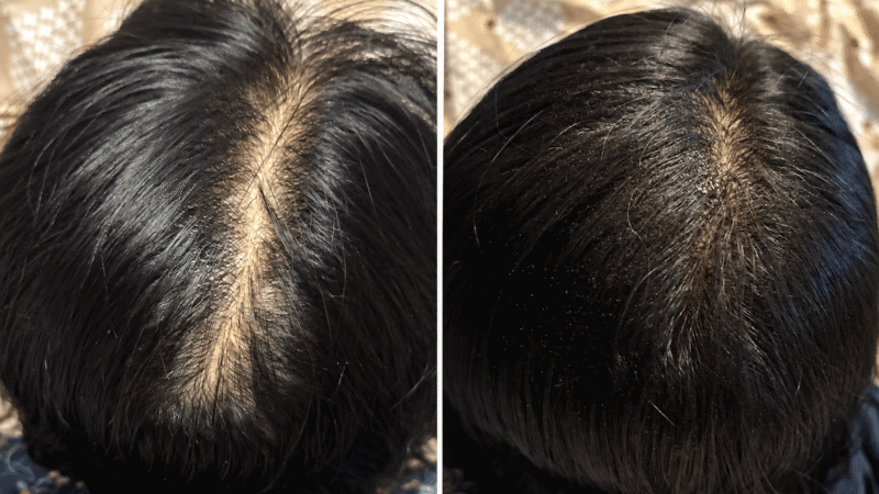 レディーストップシェード パウダーヘアのビフォーアフター画像