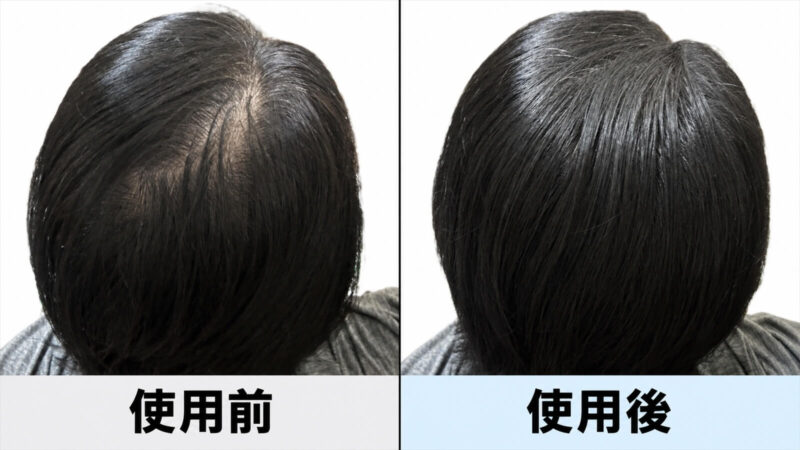 チャップアップモアシーラー写真で比較｜ふわっと自然に隠すなら「少量ずつ」がコツ