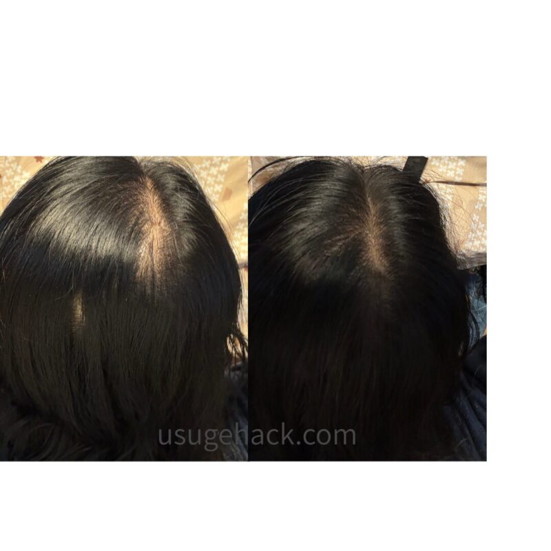 プリオール ヘアファンデーションの使用前（左）と使用後（右）の分け目の比較写真。白髪や地肌のカバー効果。