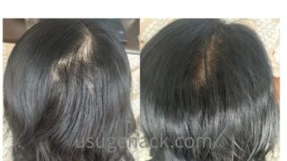 サロンドプロのヘアマニキュア使用前（左）と、使用後に地肌まで染まった状態（右）の比較写真