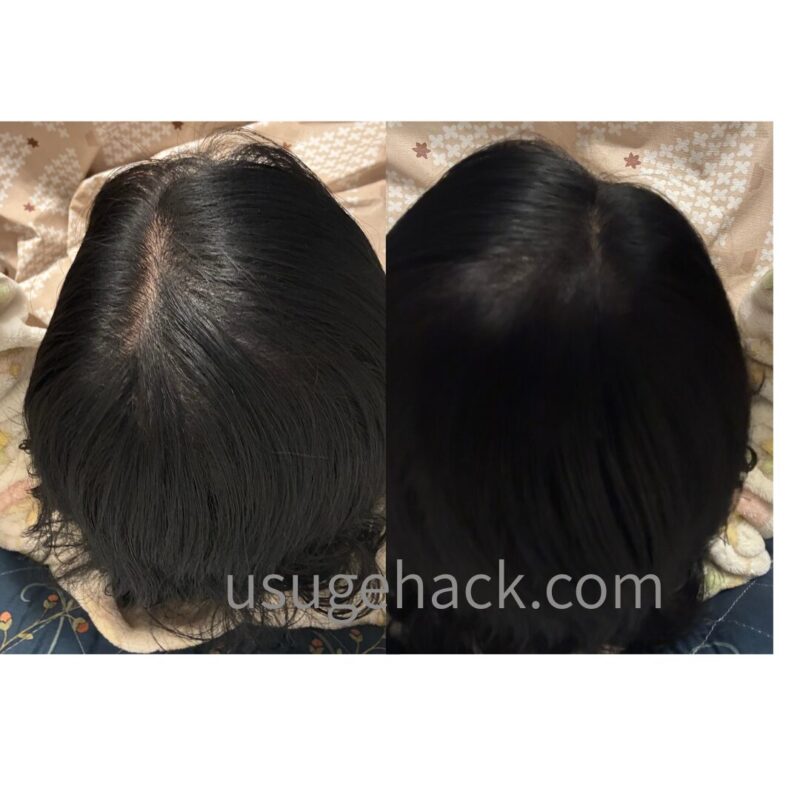 チャップアップモアスプレーの使用比較。左は全体にふんわり馴染ませた状態、右は地肌に重点的にスプレーした状態