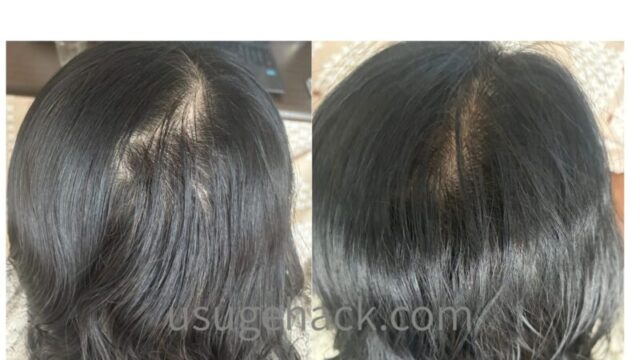 サロンドプロのヘアマニキュア使用前（左）と、使用後に地肌まで染まった状態（右）の比較写真