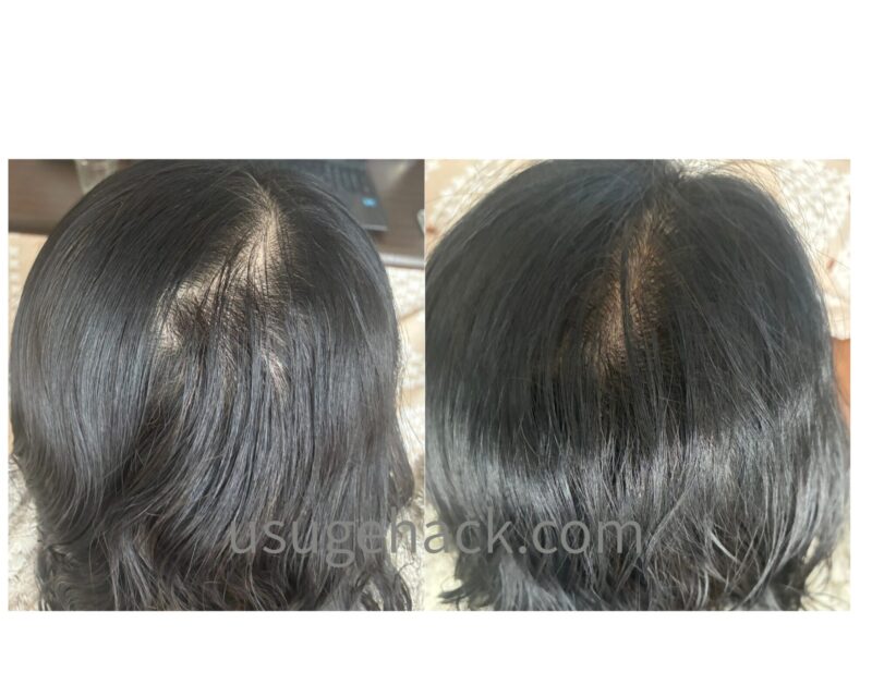 サロンドプロのヘアマニキュア使用前（左）と、使用後に地肌まで染まった状態（右）の比較写真