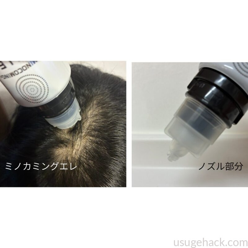 ミノカミングエレを頭皮に当てている様子（左）、ノズル部分を拡大した様子（右）