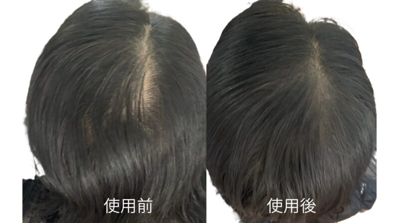 ヘアプラスビュー ファンデパウダーの使用前（左）使用後（右）の写真。
分け目の薄さが自然にカバーされています。