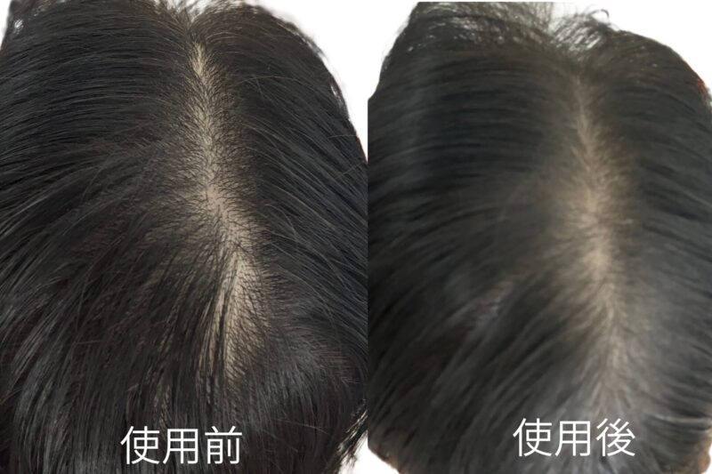 ビオルチア（Bio Lucia）ヘアファンデーションの使用前（左）と使用後（右）の比較写真。分け目の白髪隠しと地肌のボリュームアップ効果