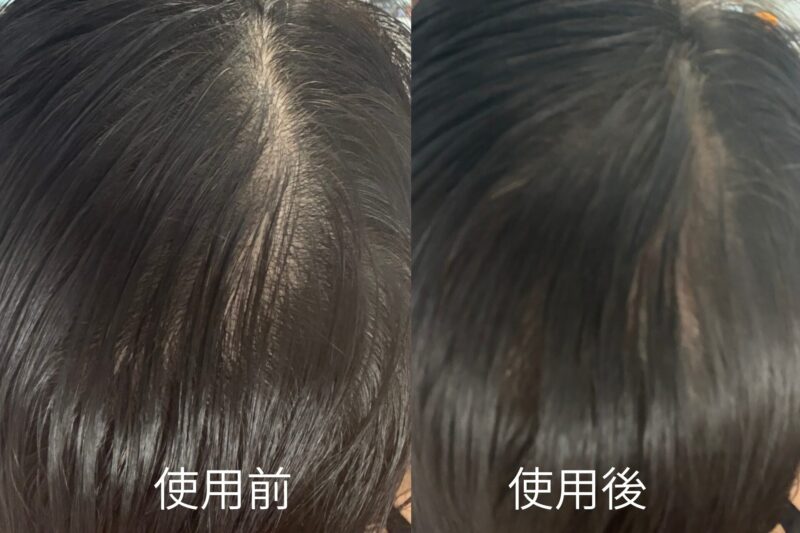 左側：使用前（Before）右側：使用後（After）｜ダークブラウン使用