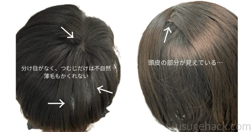 他社ウィッグを試した際の後ろ姿の比較（左：薄毛が隠れない状態、右：頭頂部の分け目が見える状態）