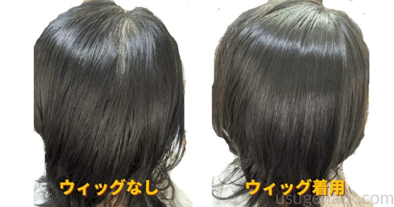 ウィッグなし（左）ウィッグ着用（右）