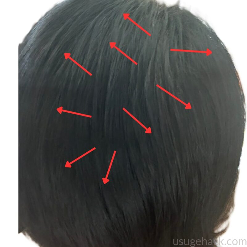 シャンプー後に生え癖が戻った後頭部の写真。赤い矢印で髪の流れが元の方向に戻っていることを示している