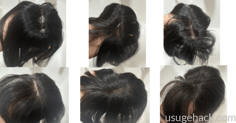 リネアストリアのヘアピースを買う前に、10種類以上のウィッグを試した