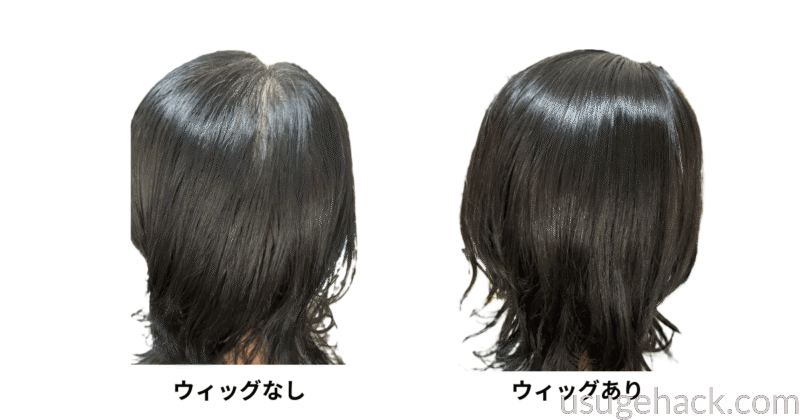 ウィッグなし(左)リネアストリアウィッグあり(右)後ろから撮影した様子