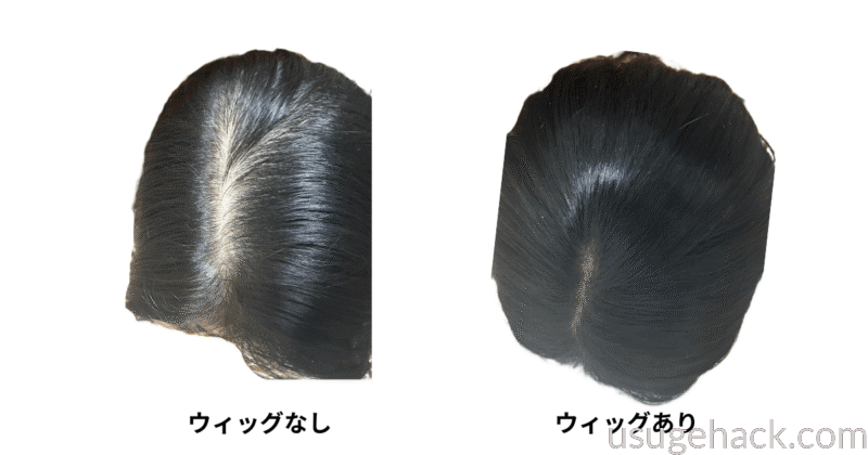 ウィッグなし(左)リネアストリアウィッグあり(右)上から撮影した様子